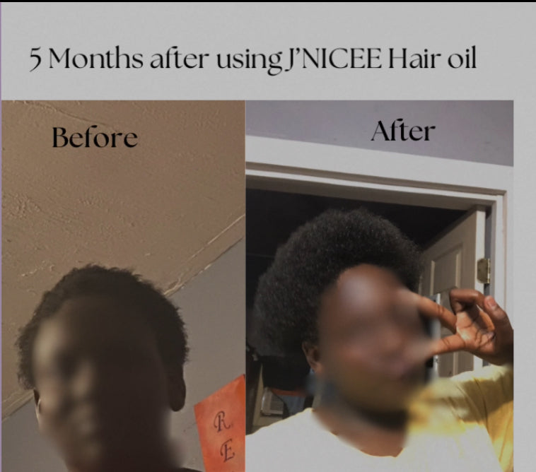 Herbal Oil: Nourishing Hair Oil